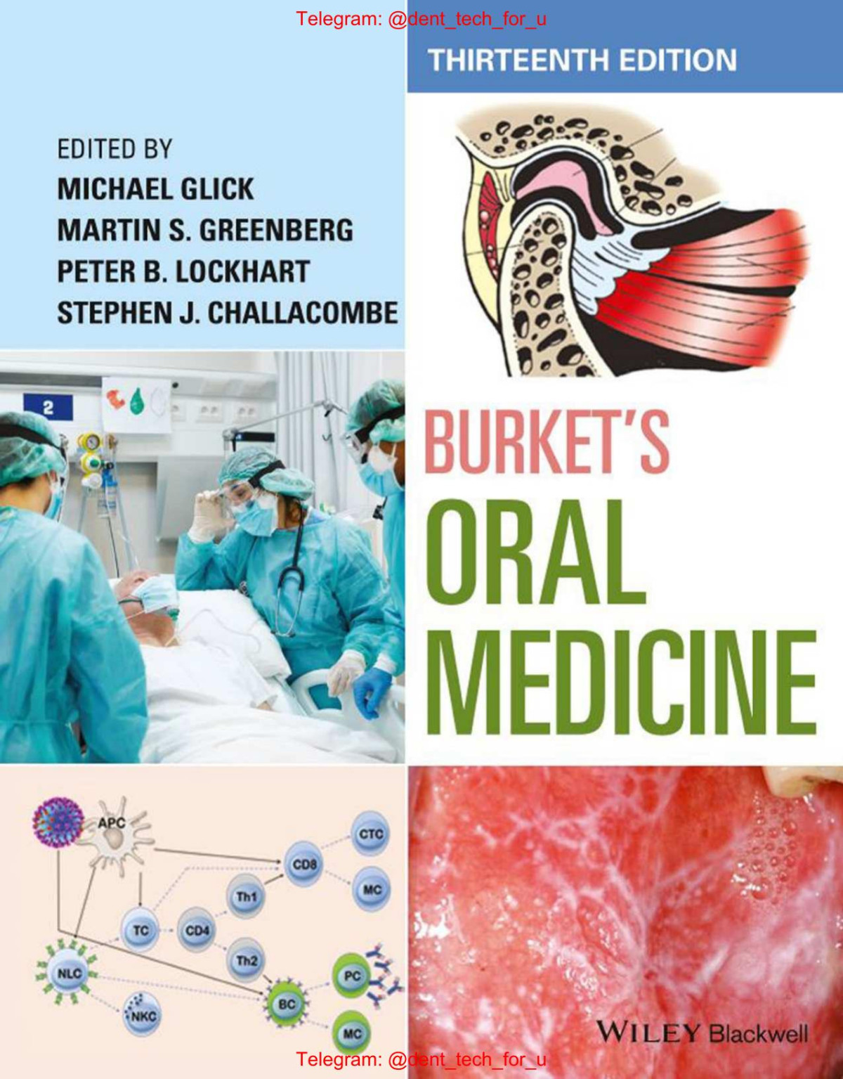 Burkets Oral Medicine Michael Glick Willey Blackwell 13th Edition 2021tls 13th Edition Michael Glick