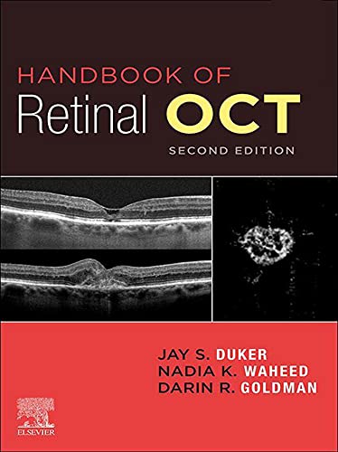 Handbook Of Retinal Oct Optical Coherence Tomography Ebook 2 Edition Jay S Duker