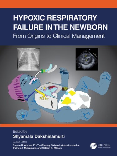 Hypoxic Respiratory Failure In The Newborn From Origins To Clinical Management 1st Edition Shyamala Dakshinamurti Editor