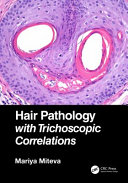 Hair Pathology With Trichoscopic Correlations 1st Edition Miteva