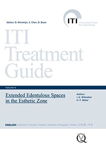Iti Treatment Guide Vol 6 Extended Edentulous Spaces In The Esthetic Zone Iti Treatment Guides 1st Edition Ed Wismeijer