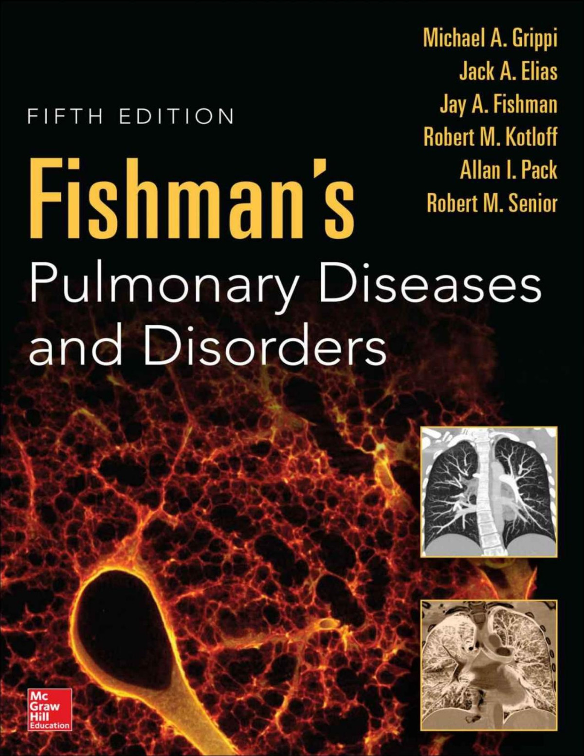 Fishmans Pulmonary Diseases And Disorders Fifth Edition Grippi