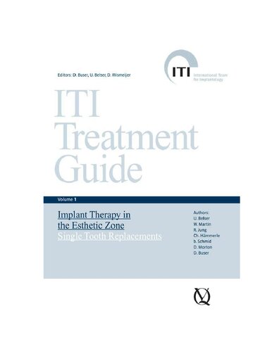 Iti Treatment Guide 1st Edition Daniel Buser U Belser D Wismeijer