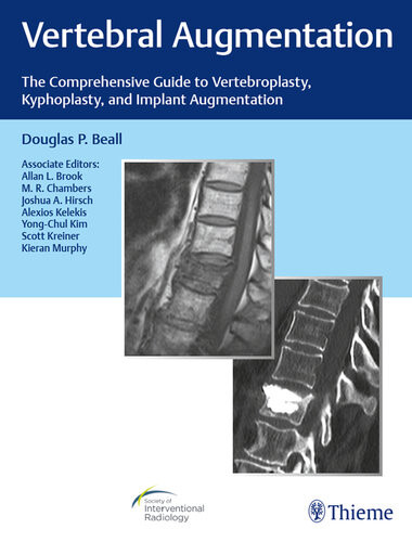 Vertebral Augmentation The Comprehensive Guide To Vertebroplasty Kyphoplasty And Implant Augmentation Society Of Interventional Radiology Douglas P Beall