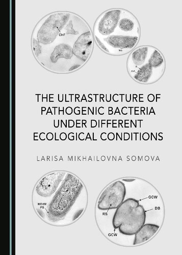 The Ultrastructure Of Pathogenic Bacteria Under Different Ecological Conditions Larisa Somova Mikhailovna
