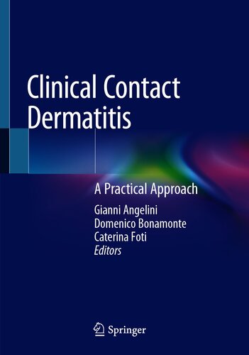 Clinical Contact Dermatitis A Practical Approach 1st Ed 2021 Gianni Angelini