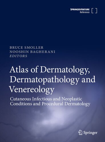 Atlas Of Dermatology Dermatopathology And Venereology Cutaneous Infectious And Neoplastic Conditions And Procedural Dermatology 1st Ed 2022 Bruce Smoller