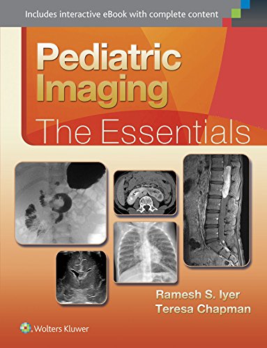 Pediatric Imaging The Essentials Essentials Series First Iyer Md