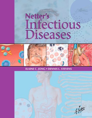 Netters Infectious Disease By Jong Elaine C Stevens Dennis L 1st By Jong Elaine C