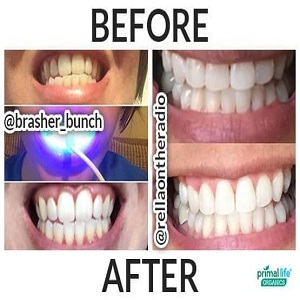 Strange Mouth Detox Makes You Appear 10 Years Younger Agniajay