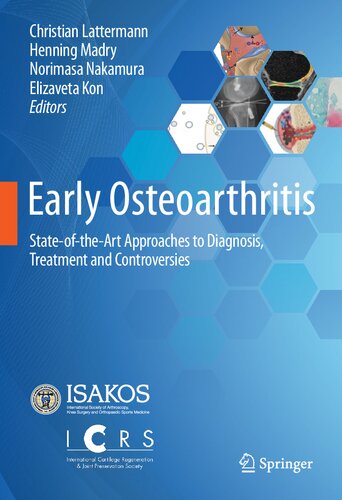 Early Osteoarthritis Stateoftheart Approaches To Diagnosis Treatment And Controversies 1st Edition Christian Lattermann