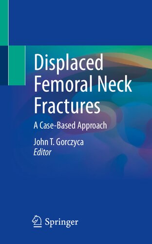 Displaced Femoral Neck Fractures A Casebased Approach 1st Edition John T Gorczyca