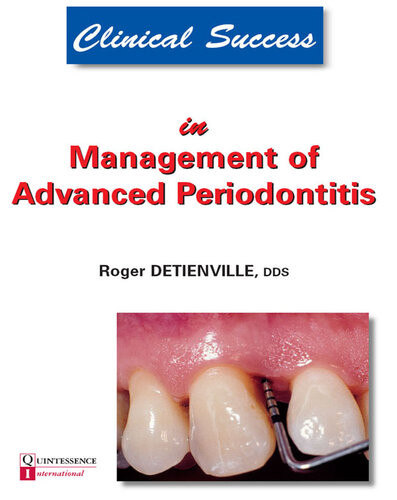 Clinical Success In Management Of Advanced Periodontitis 1st Edition Roger Detienville