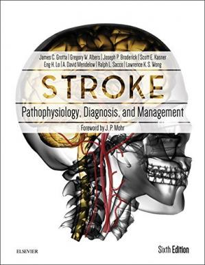 Stroke Pathophysiology Diagnosis And Management 6e 2016 6th Edition James C Grotta Md