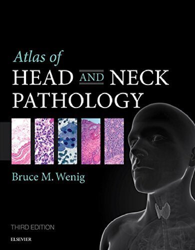 Atlas Of Head And Neck Pathology 3rd Edition Bruce M Wenig