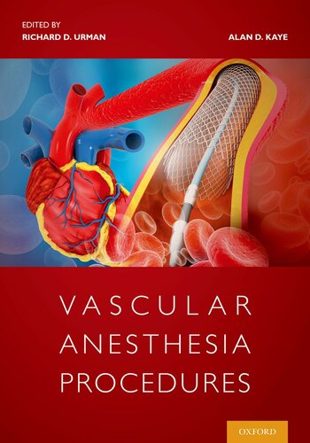 Vascular Anesthesia Procedures Richard D Urman Alan David Kaye