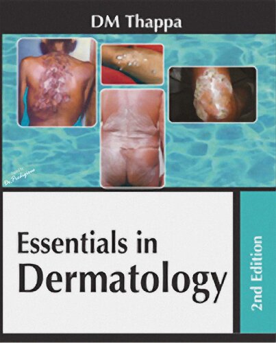Essentials In Dermatology 2nd Edition D M Thappa