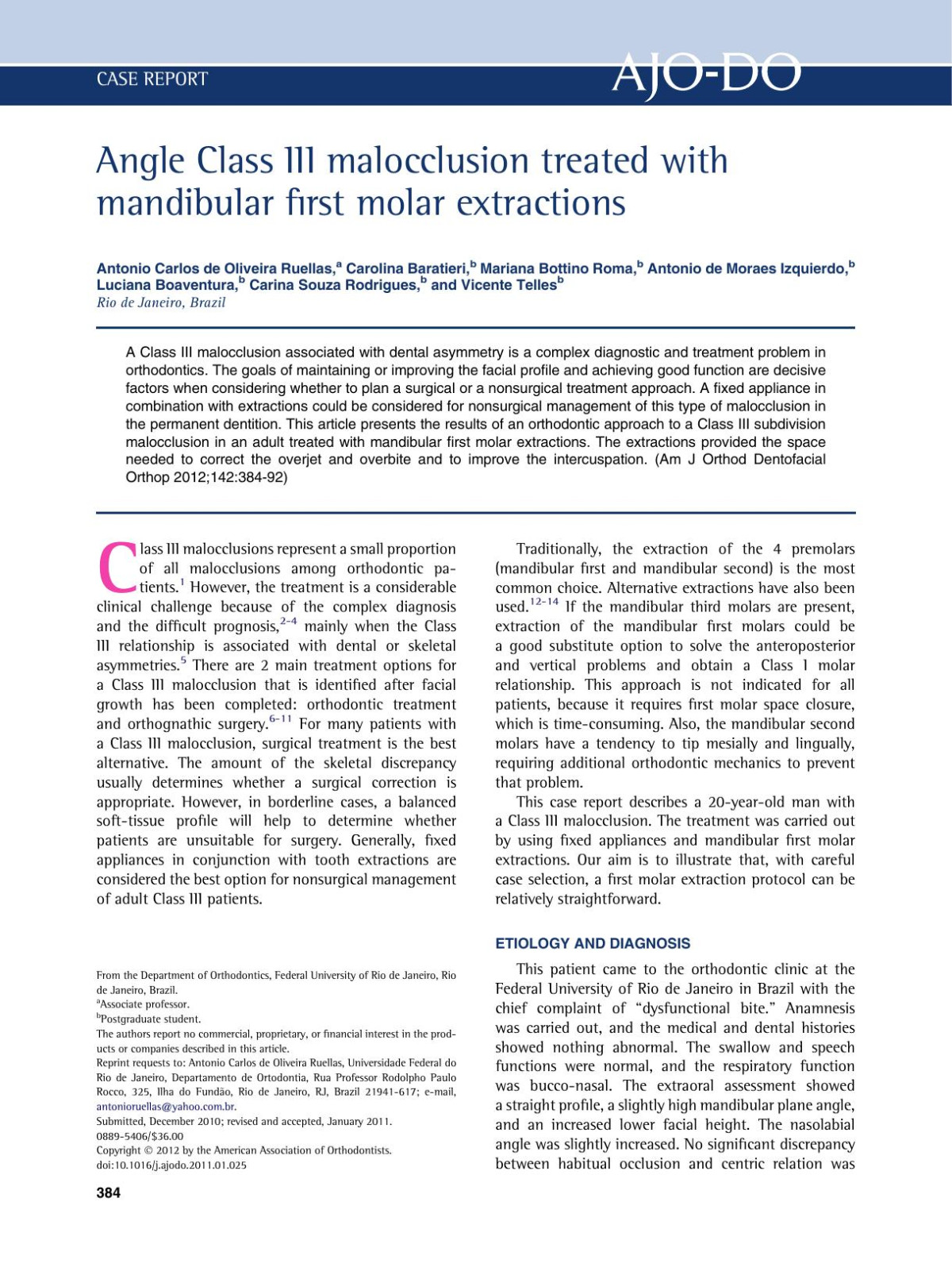 Angle Class Iii Malocclusion Treated With Mandibular First Molar Extractions