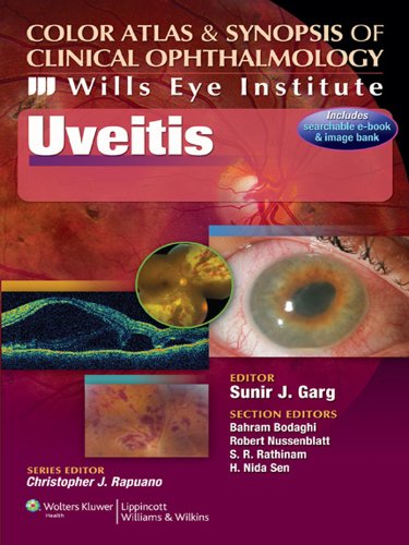 Uveitis Color Atlas And Synopsis Of Clinical Ophthalmology Wills Eye Institute Atlas Series Pappsc Md Garg