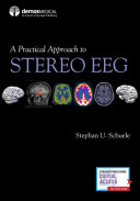 A Practical Approach To Stereo Eeg 1st Edition Stephan U Schuele