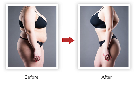 Slim Leafdietary Supplementwomen Over 40 Agniajay