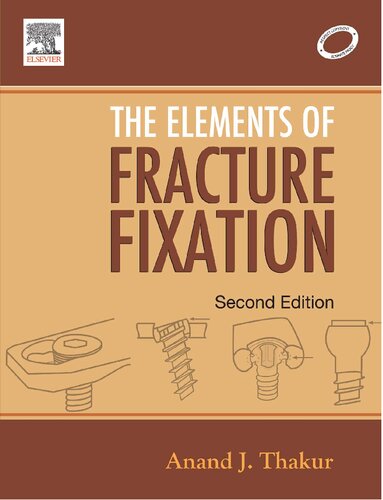The Elements Of Fracture Fixation 2nd Edition Anand J Thakur