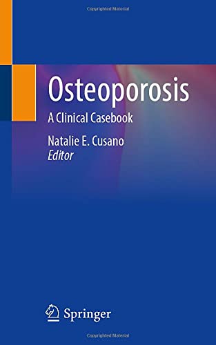 Osteoporosis A Clinical Casebook Natalie E Cusano