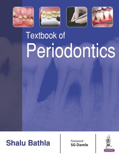 Textbook Of Periodontics 1st Edition Shalu Bathla