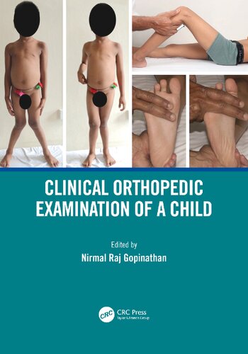 Clinical Orthopedic Examination Of A Child 1st Edition Nirmal Raj Gopinathan