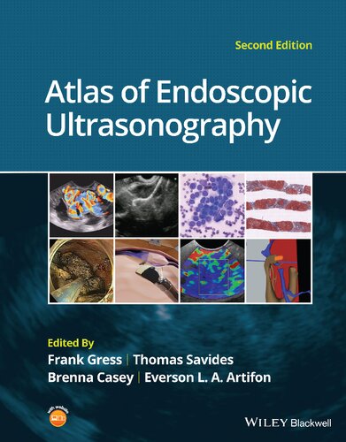 Atlas Of Endoscopic Ultrasonography 2nd Edition 2nd Edition Frank G Gress