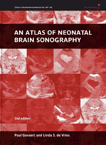 An Atlas Of Neonatal Brain Sonography 2nd Edition Paul Govaert