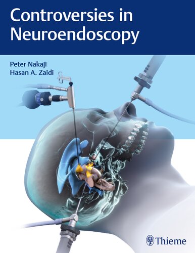 Controversies In Neuroendoscopy 1st Edition Nakaji Peter