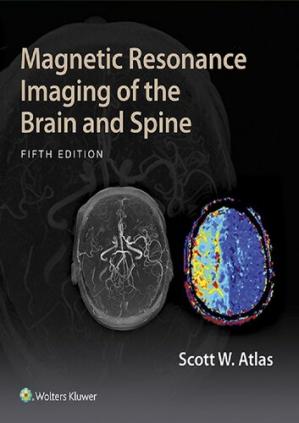 Magnetic Resonance Imaging Of The Brain And Spine 5th Edition Scott W Atlas Md