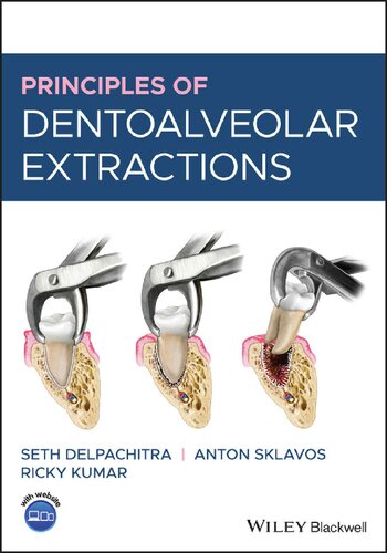 Principles Of Dentoalveolar Extractions 1st Edition Seth Delpachitra