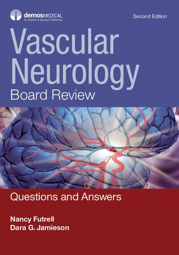Vascular Neurology Board Review Questions And Answers 2nd Edition Futrell Md