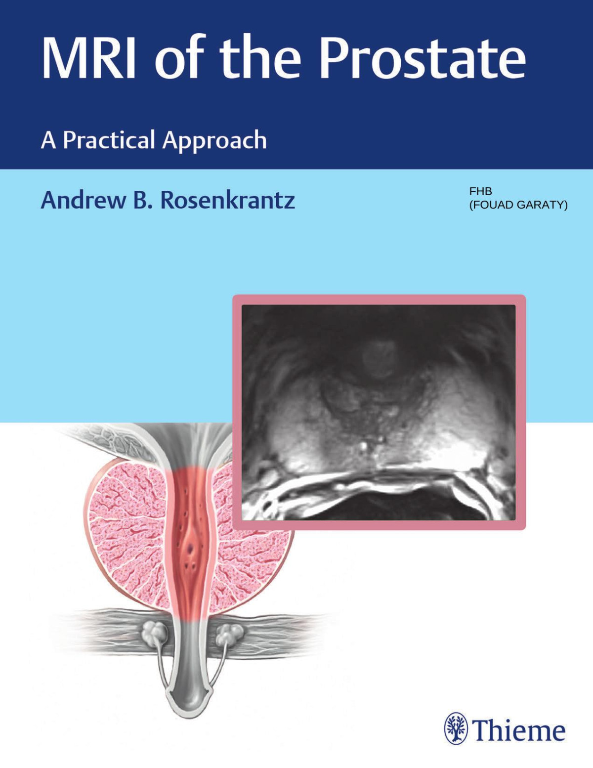Mri Of The Prostate Andrew Rosenkrantz