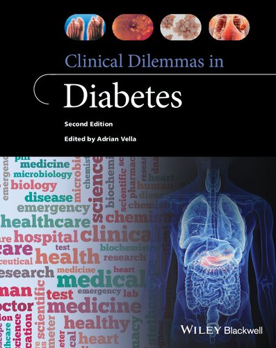 Clinical Dilemmas In Diabetes 2nd Edition 2nd Edition Adrian Vella
