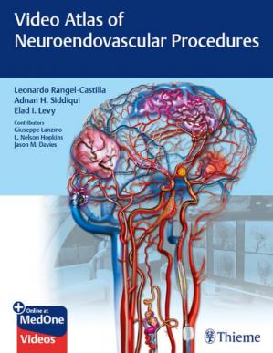 Video Atlas Of Neuroendovascular Procedures Leonardo Rangelcastilla