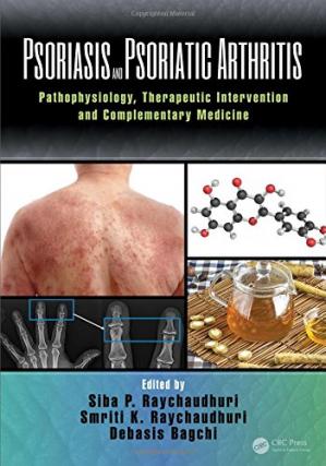 Psoriasis And Psoriatic Arthritis Pathophysiology Therapeutic Intervention And Complementary Medicine Siba P Raychaudhuri