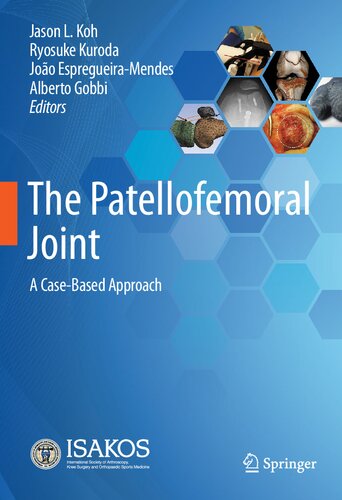 The Patellofemoral Joint A Casebased Approach 1st Ed 2022 Jason L Koh Editor