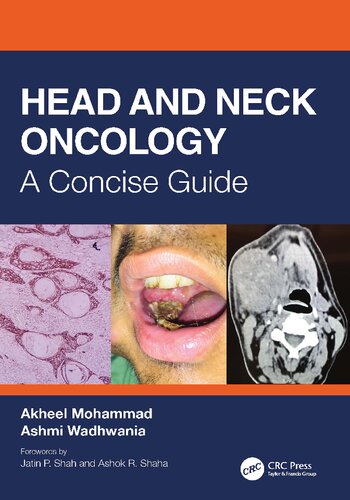 Head And Neck Oncology A Concise Guide Akheel Mohammad Ashmi Wadhwania