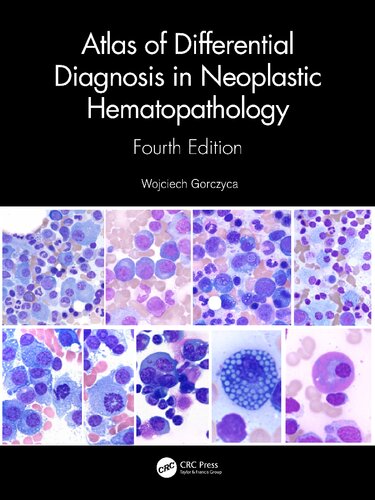 Atlas Of Differential Diagnosis In Neoplastic Hematopathology 4th Edition Gorczyca