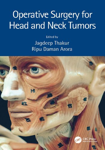Operative Surgery For Head And Neck Tumors 1st Edition Jagdeep Thakur