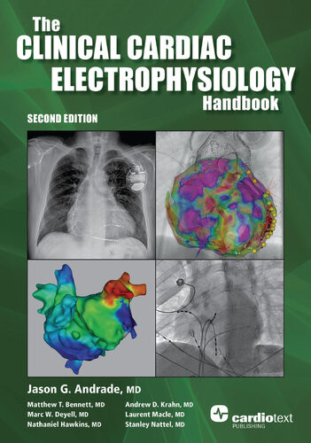 Clinical Cardiac Electrophysiology Handbook Second Edition 2nd Edition Jason Andrade