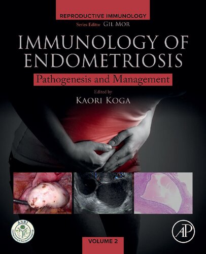Immunology Of Endometriosis Pathogenesis And Management 1st Edition Kaori Koga