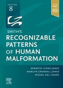Smiths Recognizable Patterns Of Human Malformation 8th Edition Kenneth Lyons Jones