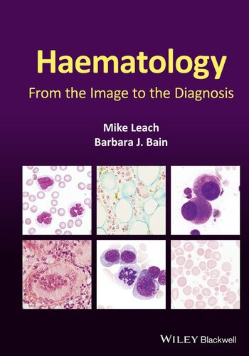 Haematology From The Image To The Diagnosis 1st Edition Leach