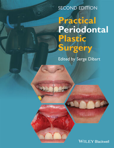 Practical Periodontal Plastic Surgery 2nd Edition 2nd Edition Serge Dibart
