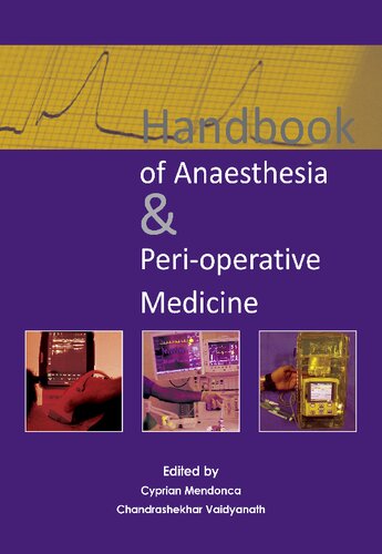 Handbook Of Anaesthesia Perioperative Medicine 1st Edition Mendonca Md Frca