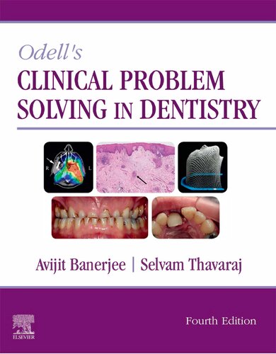 Odells Clinical Problem Solving In Dentistry 4th Edition Avijit Banerjee